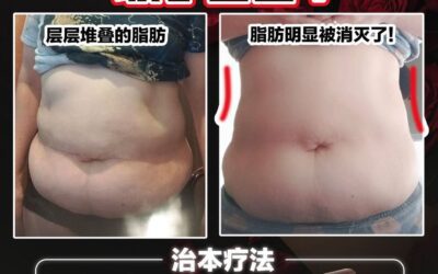 为什么你的脂肪总是“特别顽固”？ 真正的原因可能不是你吃太多。